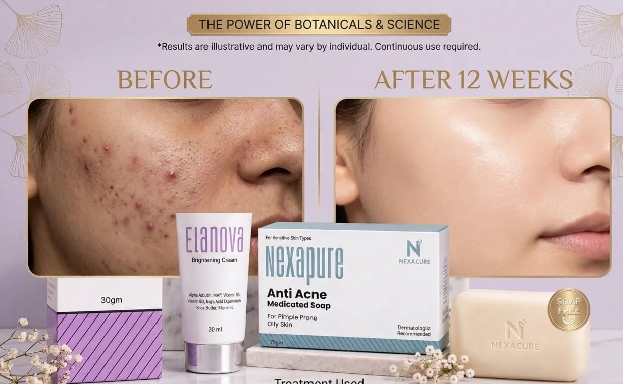 Anti-Acne Essential Kit( CREAM+SOAP)