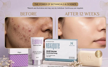 Anti-Acne Essential Kit( CREAM+SOAP)